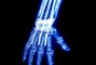 x men origins - X-Men Origins : Wolverine