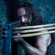 michael sheen arm  