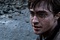 harry-abime-jpg